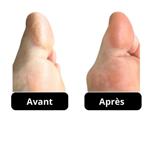 La crème + les chaussettes hydratantes